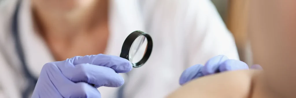 A dermatologist examining a patient's skin with a magnifying glass