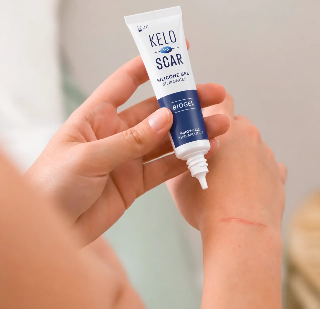 Bilekteki iyileşmiş bir yara izinin yanında KELOSCAR BIOGEL tüpü tutan bir kişi